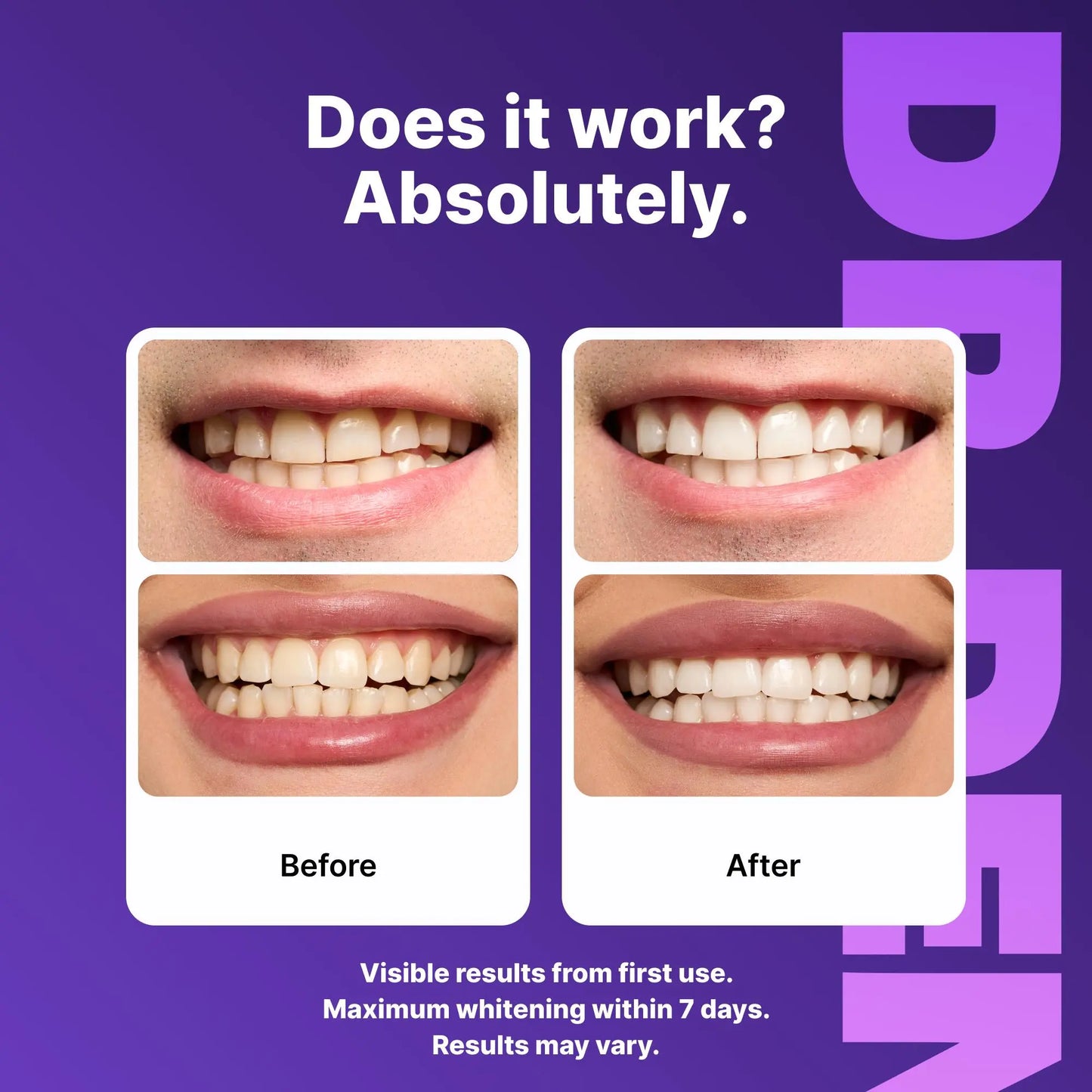 Purple Teeth Whitening Strips – Enamel Safe, Peroxide-Free