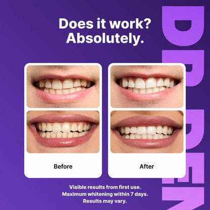 Purple Teeth Whitening Strips – Enamel Safe, Peroxide-Free