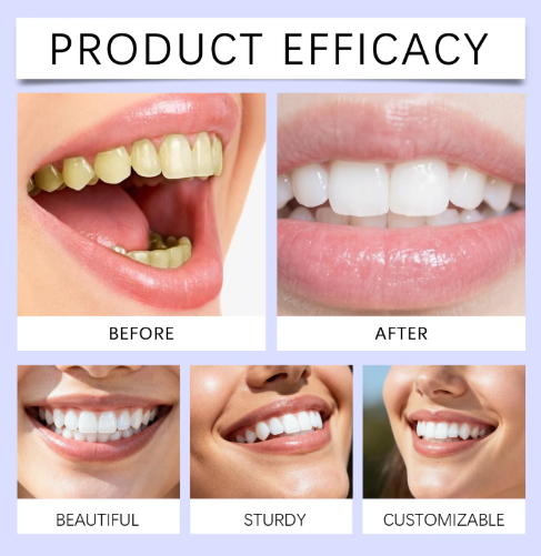 Purple Teeth Whitening Strips – Enamel Safe, Peroxide-Free
